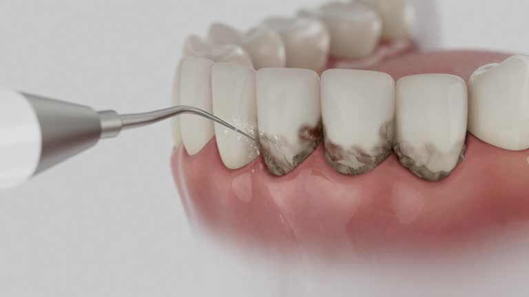 Reliable Tooth Extraction contractor in Upton County County, TX by Dentist Open Now